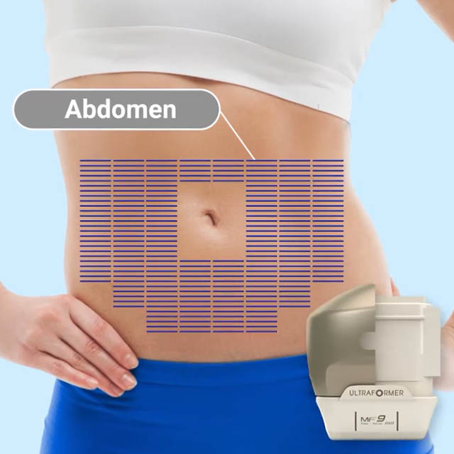 Abdomen