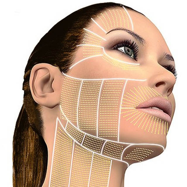 HIFU Full Face
