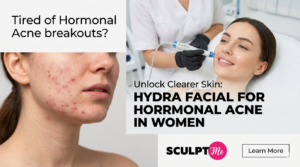 HydraFacial for hormonal acne in women